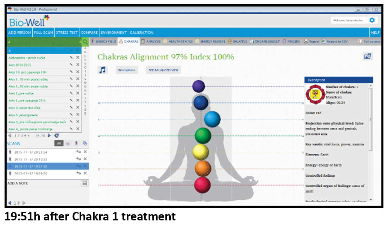 Chakras - after Chakras - after